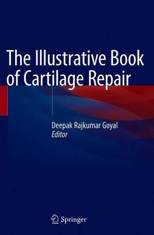 The Illustrative Book of Cartilage Repair de Deepak Rajkumar Goyal