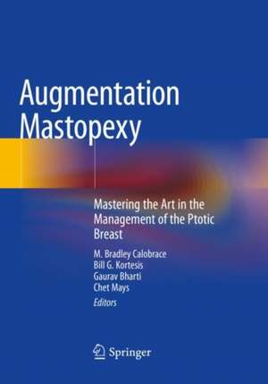 Augmentation Mastopexy: Mastering the Art in the Management of the Ptotic Breast de M. Bradley Calobrace