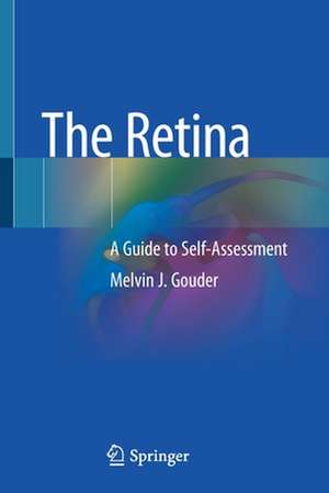 The Retina: A Guide to Self-Assessment de Melvin J. Gouder