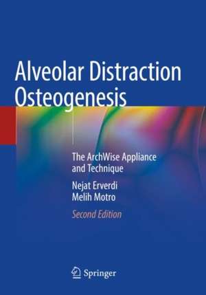 Alveolar Distraction Osteogenesis: The ArchWise Appliance and Technique de Nejat Erverdi