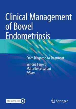 Clinical Management of Bowel Endometriosis: From Diagnosis to Treatment de Simone Ferrero