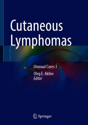 Cutaneous Lymphomas: Unusual Cases 3 de Oleg E. Akilov