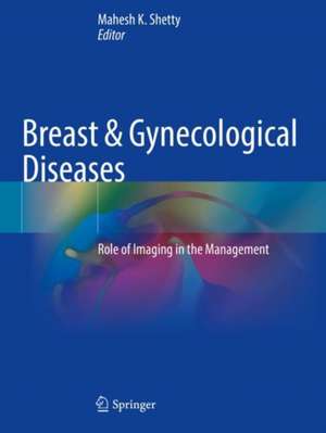 Breast & Gynecological Diseases: Role of Imaging in the Management de Mahesh K. Shetty