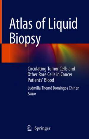 Atlas of Liquid Biopsy: Circulating Tumor Cells and Other Rare Cells in Cancer Patients’ Blood de Ludmilla Thomé Domingos Chinen