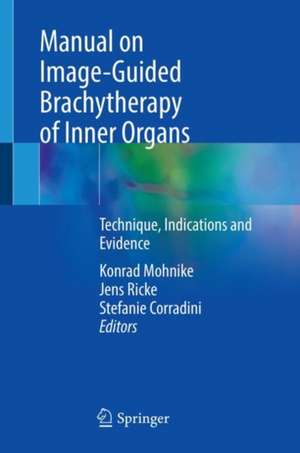 Manual on Image-Guided Brachytherapy of Inner Organs: Technique, Indications and Evidence de Konrad Mohnike