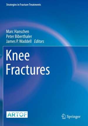 Knee Fractures de Marc Hanschen