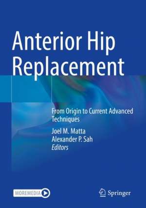 Anterior Hip Replacement: From Origin to Current Advanced Techniques de Joel M. Matta