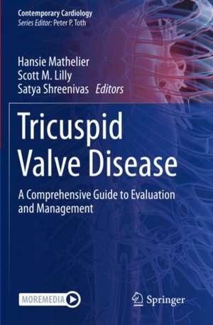 Tricuspid Valve Disease: A Comprehensive Guide to Evaluation and Management de Hansie Mathelier