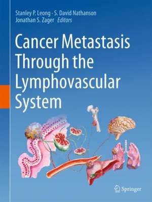 Cancer Metastasis Through the Lymphovascular System de Stanley P. Leong