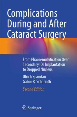 Complications During and After Cataract Surgery: From Phacoemulsification Over Secondary IOL Implantation to Dropped Nucleus de Ulrich Spandau