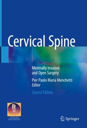 Cervical Spine: Minimally Invasive and Open Surgery de Pier Paolo Maria Menchetti