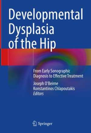 Developmental Dysplasia of the Hip: From Early Sonographic Diagnosis to Effective Treatment de Joseph O'Beirne