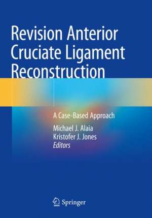 Revision Anterior Cruciate Ligament Reconstruction: A Case-Based Approach de Michael J. Alaia