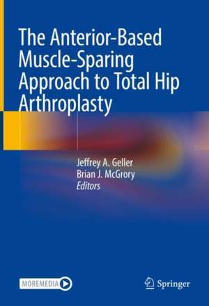 The Anterior-Based Muscle-Sparing Approach to Total Hip Arthroplasty de Jeffrey A. Geller