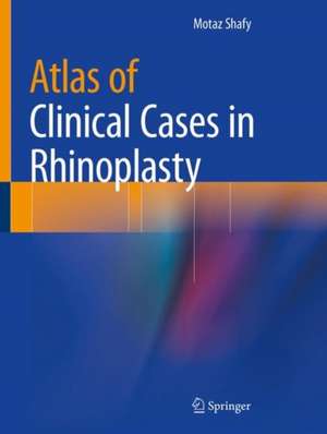 Atlas of Clinical Cases in Rhinoplasty: Volume I de Motaz H. A. Shafy