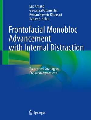 Frontofacial Monobloc Advancement with Internal Distraction: Tactics and Strategy in Faciocraniosynostosis de Eric Arnaud