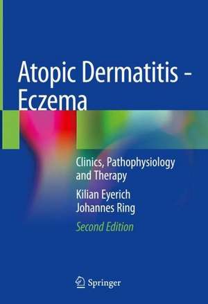 Atopic Dermatitis - Eczema: Clinics, Pathophysiology and Therapy de Kilian Eyerich