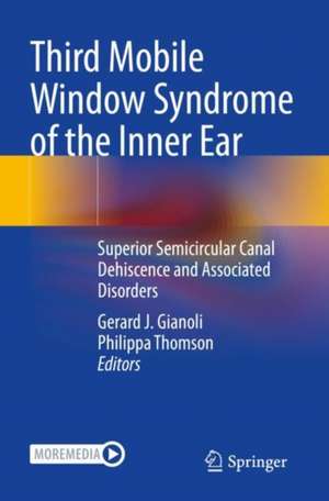 Third Mobile Window Syndrome of the Inner Ear: Superior Semicircular Canal Dehiscence and Associated Disorders de Gerard J. Gianoli