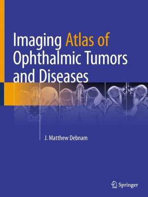 Imaging Atlas of Ophthalmic Tumors and Diseases de J. Matthew Debnam