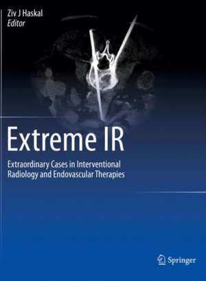 Extreme IR: Extraordinary Cases in Interventional Radiology and Endovascular Therapies de Ziv J Haskal