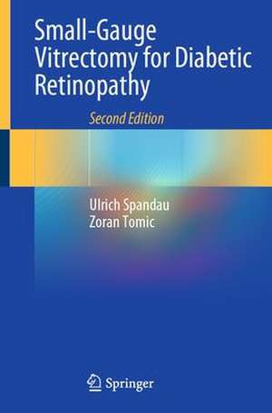 Small-Gauge Vitrectomy for Diabetic Retinopathy de Ulrich Spandau