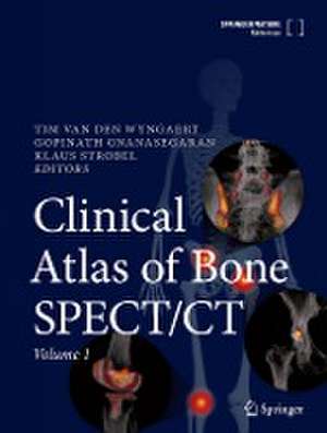 Clinical Atlas of Bone SPECT/CT de Tim Van den Wyngaert