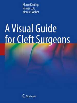 Visual Guide for Cleft Surgeons de Manuel Weber