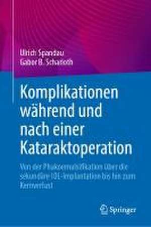 Komplikationen während und nach einer Kataraktoperation: Von der Phakoemulsifikation über die sekundäre IOL-Implantation bis hin zum Kernverlust de Ulrich Spandau