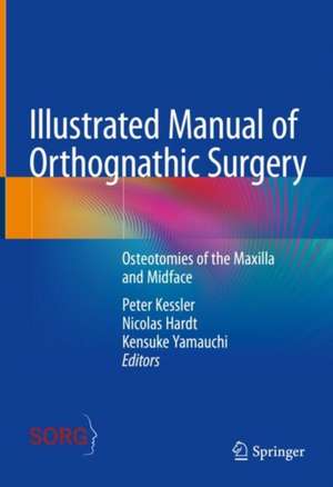 Illustrated Manual of Orthognathic Surgery : Osteotomies of the Maxilla and Midface de Peter Kessler