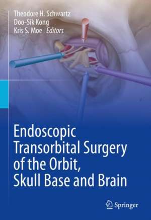 Endoscopic Transorbital Surgery of the Orbit, Skull Base and Brain de Theodore H. Schwartz