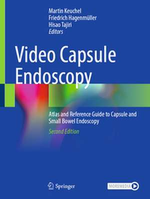 Video Capsule Endoscopy de Martin Keuchel
