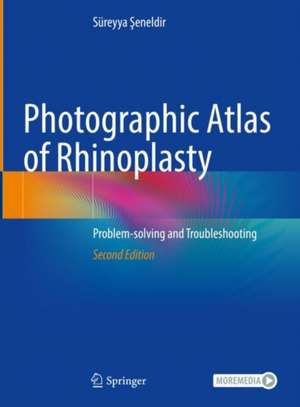 Photographic Atlas of Rhinoplasty: Problem-solving and Troubleshooting de Süreyya Şeneldir