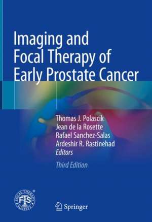 Imaging and Focal Therapy of Early Prostate Cancer de Thomas J. Polascik