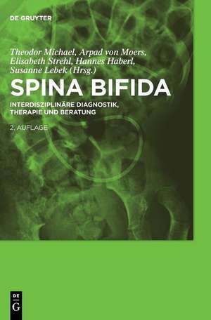 Spina Bifida: Interdisziplinare Diagnostik, Therapie Und Beratung de Theodor Michael