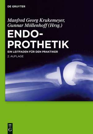 Endoprothetik: Ein Leitfaden für den Praktiker de Manfred Georg Krukemeyer