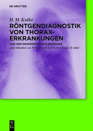 Röntgendiagnostik von Thoraxerkrankungen: Von der Deskription zur Diagnose de H. M. Kulke