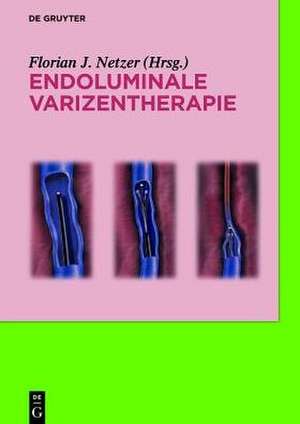 Endoluminale Varizentherapie de Florian Johannes Netzer