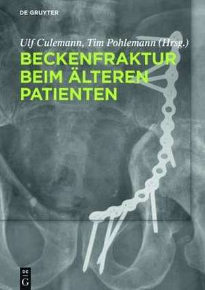 Beckenfraktur beim älteren Patienten de Ulf Culemann