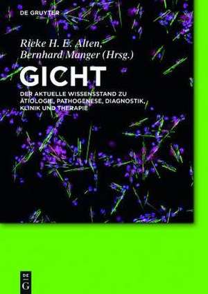 Gicht: Der aktuelle Wissensstand zu Ätiologie, Pathogenese, Diagnostik, Klinik und Therapie de Rieke H. E. Alten