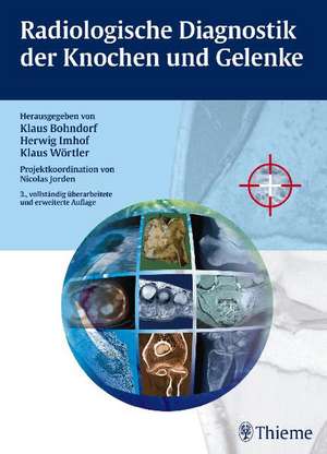 Radiologische Diagnostik der Knochen und Gelenke de Klaus Bohndorf