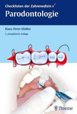 Checklisten der Zahnmedizin Parodontologie de Hans-Peter Müller