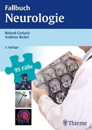 Fallbuch Neurologie de Rolan Gerlach