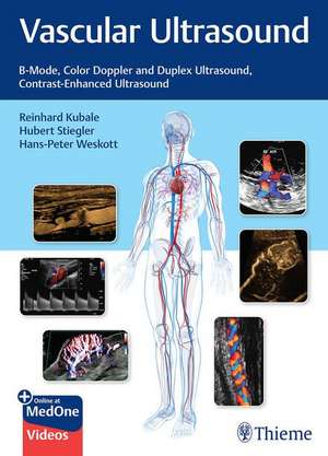 Vascular Ultrasound – B–Mode, Color Doppler and Duplex Ultrasound, Contrast–Enhanced Ultrasound de Reinhard Kubale