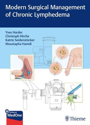 Modern Surgical Management of Chronic Lymphedema de Yves Harder