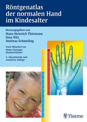 Röntgenatlas der normalen Hand im Kindesalter de Hans-Heinrich Thiemann