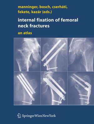 Internal fixation of femoral neck fractures: An Atlas de Jenó Manninger