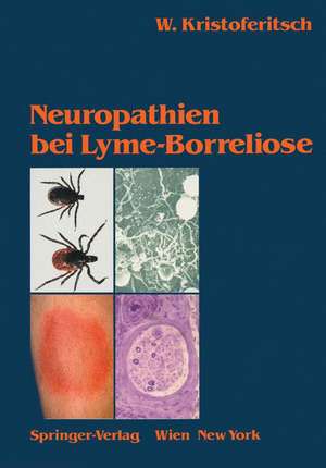 Neuropathien bei Lyme-Borreliose de Wolfgang Kristoferitsch