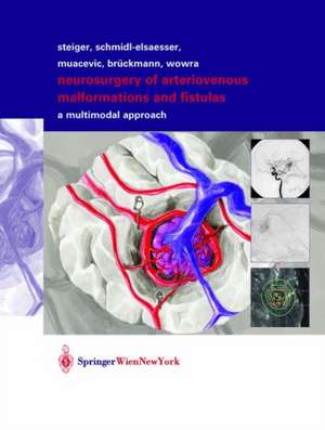 Neurosurgery of Arteriovenous Malformations and Fistulas: A Multimodal Approach de Robert Schmid-Elsaesser