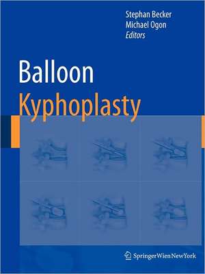 Balloon Kyphoplasty de Stephan Becker