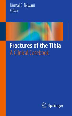 Fractures of the Tibia: A Clinical Casebook de Nirmal C. Tejwani